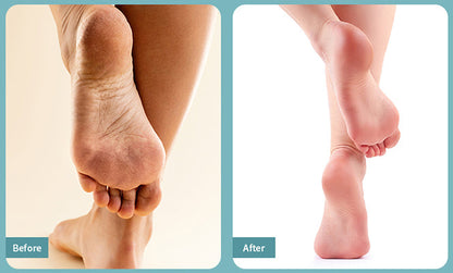 Nano Glass Foot File – Crystal Callus Remover for Heels & Feet